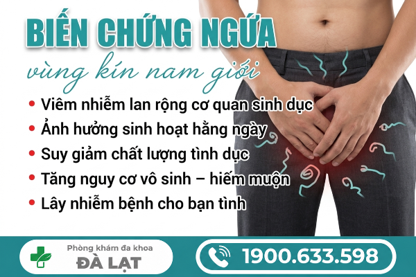 Hình ảnh minh họa